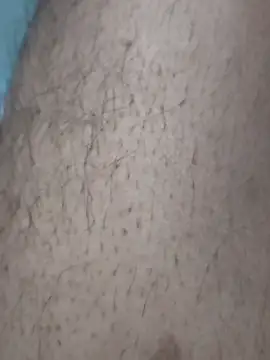 Snapshot of yashudick chatting on March 2, 2026, 4:35 am yashudick online show from March 2, 2026, 4:35 am